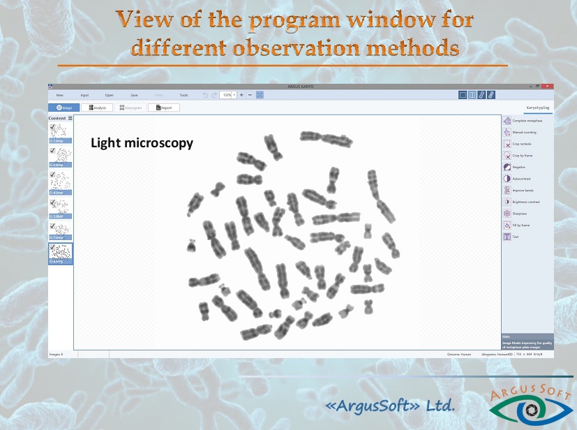 نرم افزار کاریوتایپ Karyotype