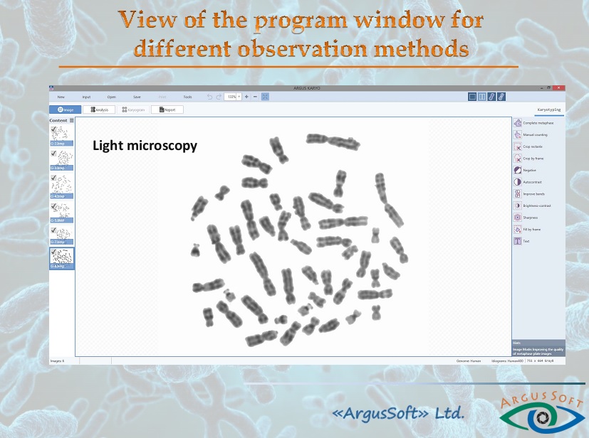 نرم افزار کاریوتایپ Karyotype